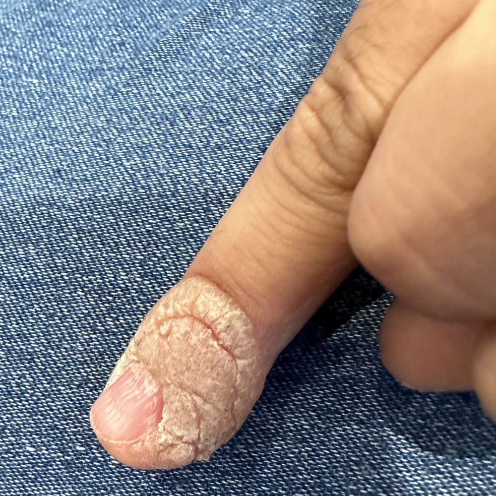 Man's finger on a fabric